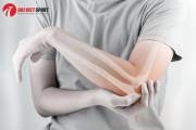 Dấu hiệu nhận biết và điều trị gãy xương tay